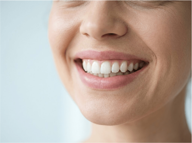 Veneers & Smile Design